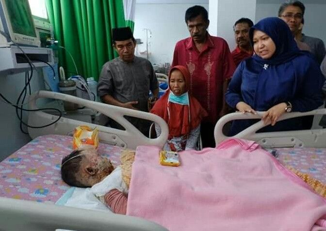 Bupati Masnah Jenguk Anak Korban Kebakaran Desa Bertam