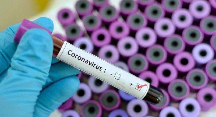 Pasien Permata Hati Bungo Dinyatakan Negativ Terkena Virus Corona