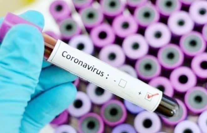 Jumlah Kematian Akibat Virus Corona di Spanyol Melampaui China