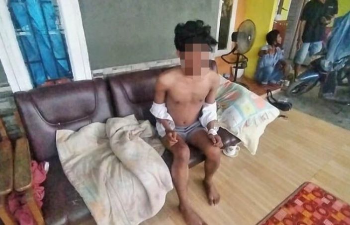 Aksi Begal Kembali Terjadi di Kota Jambi, Korban Alami Luka Bacok