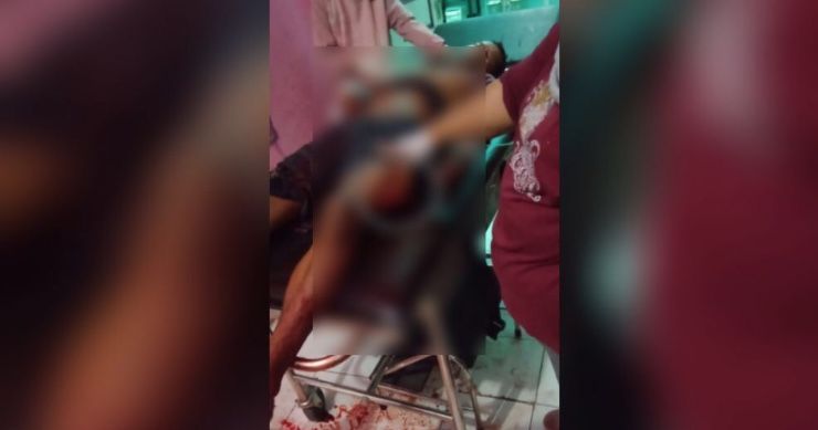 Warga Kuala Jambi Dibacok, Korban Alami Luka Robek di Lengan dan Paha