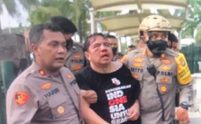 Parah Banget! Wajah Ade Armando Babak Belur Dipukuli di Demo 11 April, Celananya Ikut Dilucuti