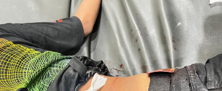 Duel Antar Remaja di Kota Jambi, Celurit Panjang Menancap di Tubuh Korban