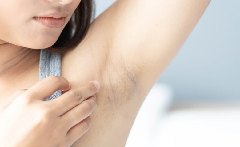 Ketiak Bau, Gelap, & Cepat Basah? Saatnya Beralih ke Deodorant Natural yang Beneran Bekerja dari Dalam