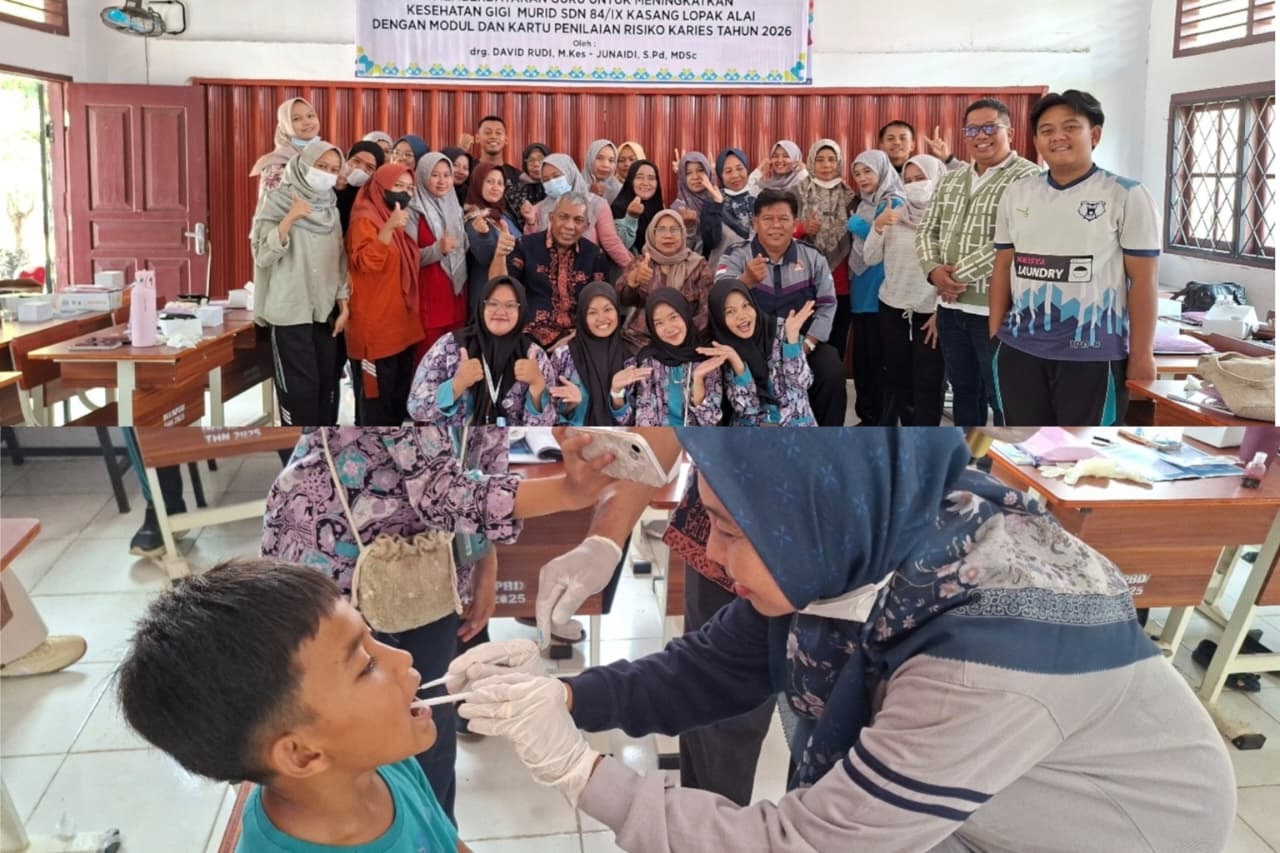 Poltekkes Dorong Guru Jadi Kader Deteksi Risiko Karies di Sekolah