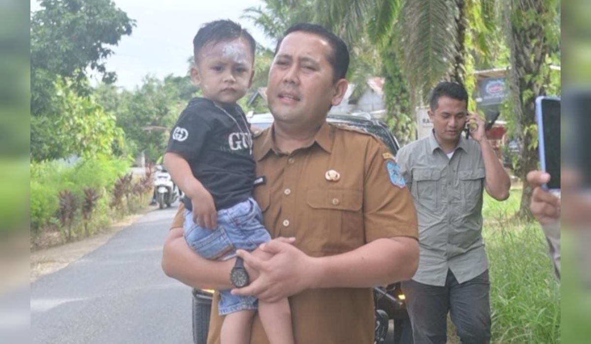 Bupati H M Syukur Selamatkan Seorang Balita dari Maut
