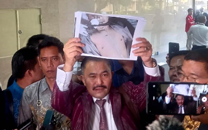 Kamaruddin Bocorkan Hasil Autopsi Brigadir J: Jari Manis dan Kelingking Patah hingga Tulang Tengkorak Retak
