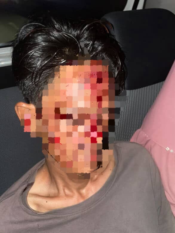 Viral di Medsos, Pria di Jambi Jadi Korban Pembacokan Usai Antar Wanita ke Pulau Pandan 