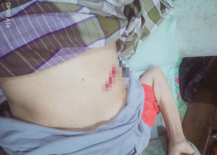 Tak Ada Biaya! Luka Operasi Terbuka, Warga Simpang Rimbo Ini Hanya Bisa Menahan Sakit di Rumah