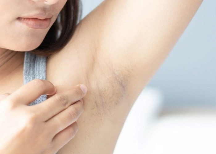 Ketiak Adem, Cerah, dan Anti Bau Sepanjang Hari: Rahasia Kecil untuk Hidup Lebih Nyaman