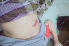 Tak Ada Biaya! Luka Operasi Terbuka, Warga Simpang Rimbo Ini Hanya Bisa Menahan Sakit di Rumah