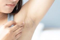 Ketiak Adem, Cerah, dan Anti Bau Sepanjang Hari: Rahasia Kecil untuk Hidup Lebih Nyaman