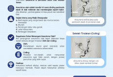 Aneurisma Cidera Otak Serius, Siloam Hospitals Jambi Lakukan Tindakan Tanpa Bedah